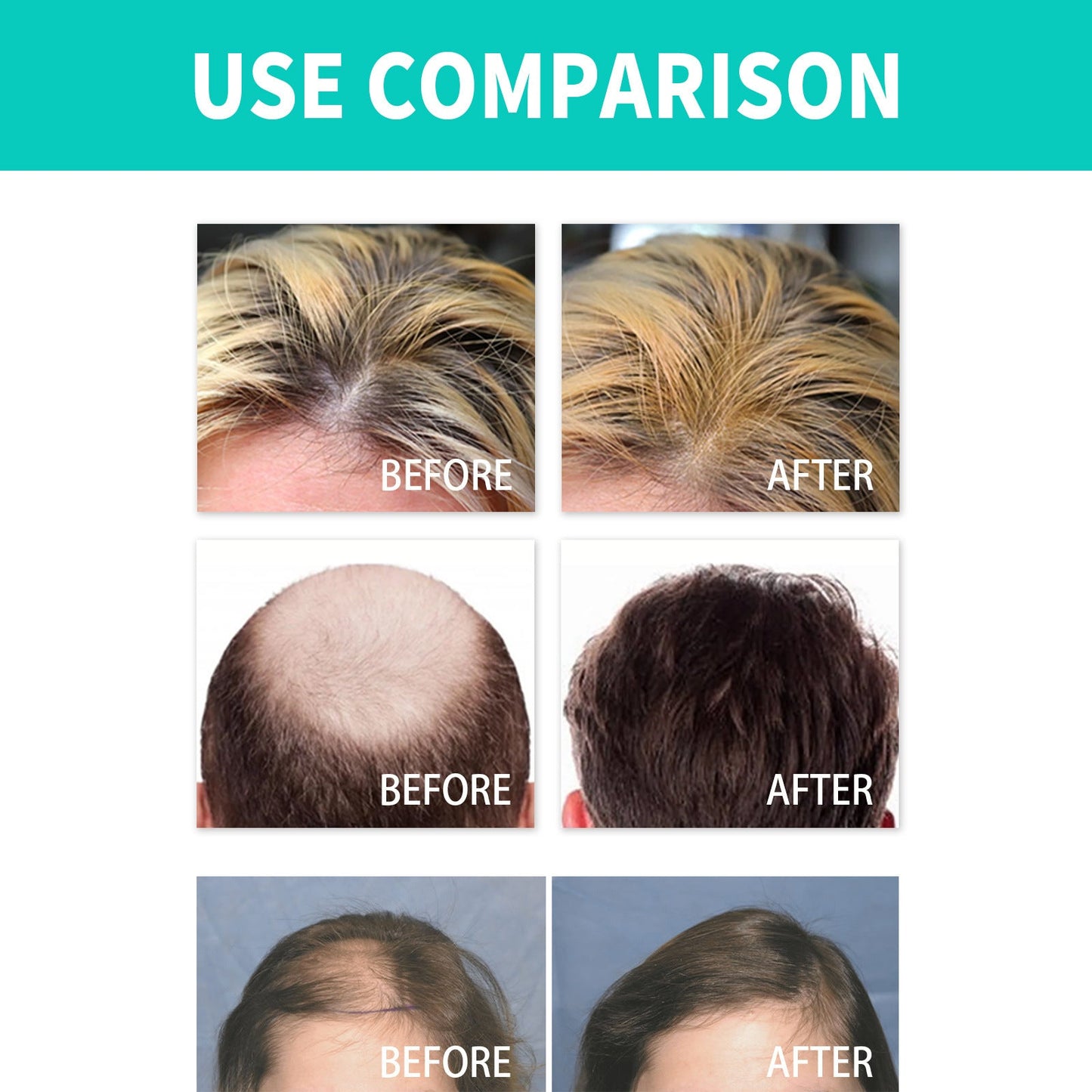 Thick Hair Sphere Powerful Hair Treatment