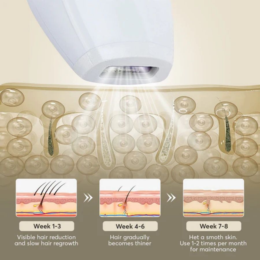 Laser Hair Removal 900,000 Flashes 5 Gears IPL Laser Epilator Hair