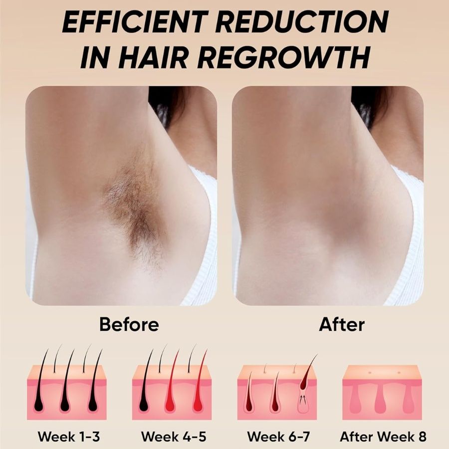 Laser Hair Removal 900,000 Flashes 5 Gears IPL Laser Epilator Hair